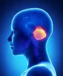 Ataxia